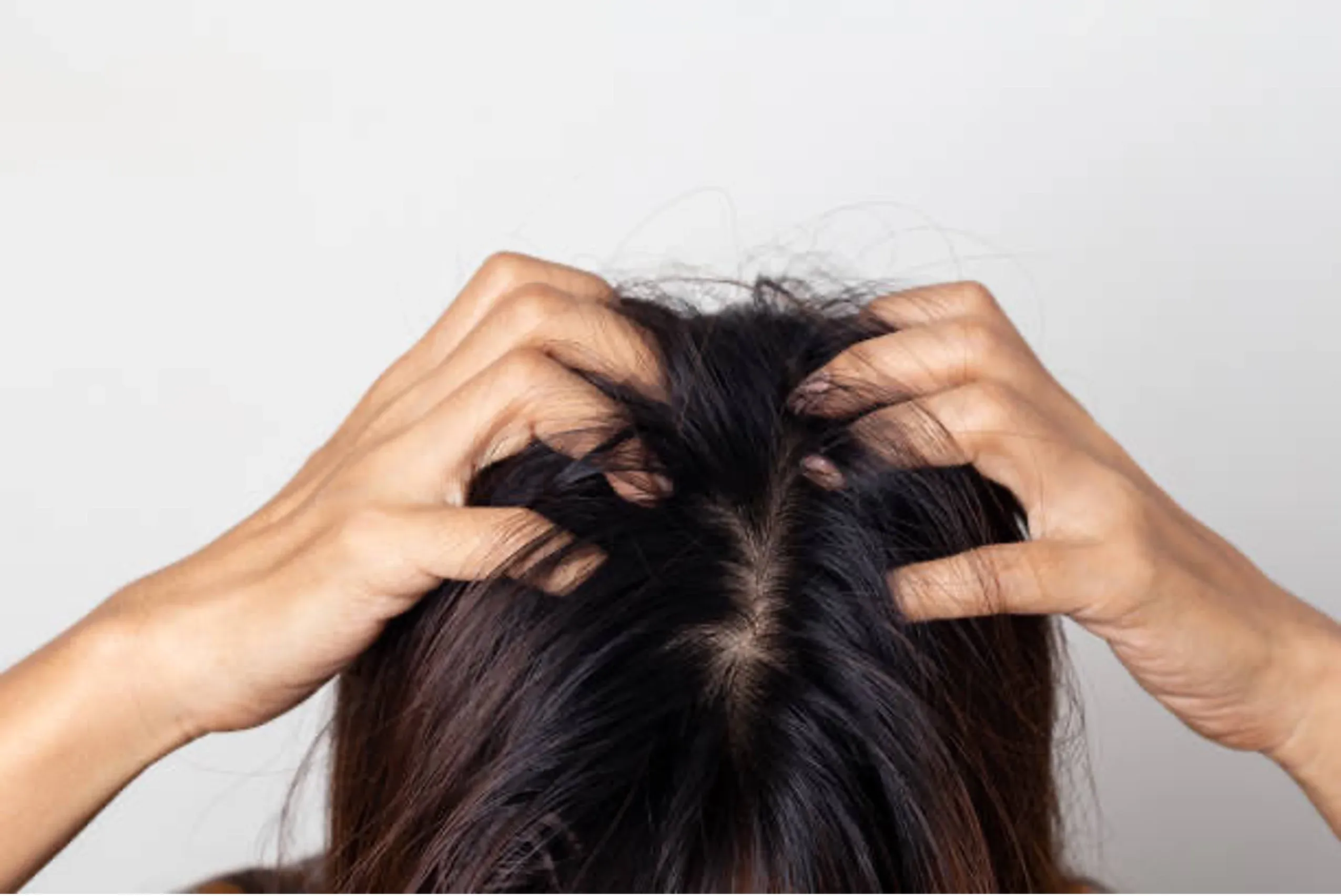 Is Your Shampoo Itching to Kill You?