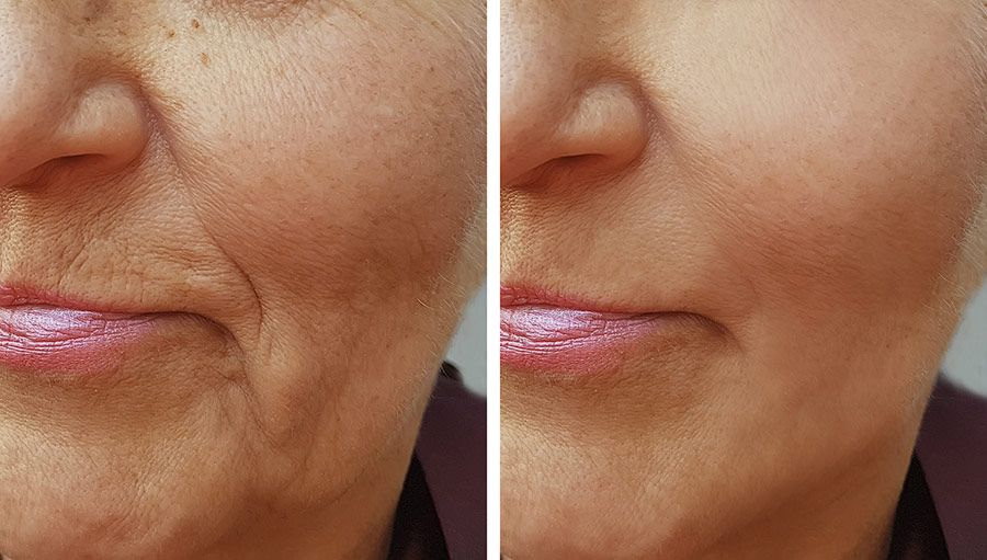 Outsmart Your Aging Skin: Top Anti-Aging Products that Deliver