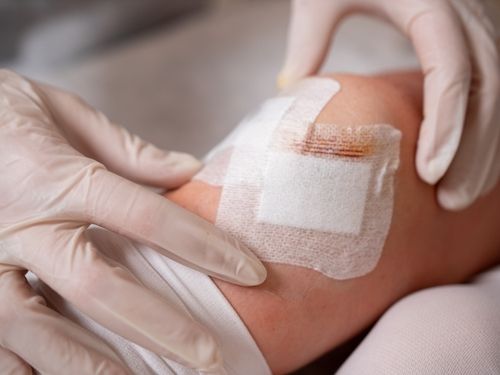 The Art of Dressing Bizarre: Mastering Proper Wound Care