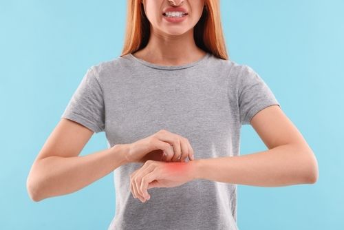 The Brute Truth About Battling Eczema: It's Not Just Skin Deep