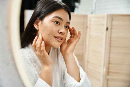 The "Eat or Retreat" Guide to Acne-Fuelling Foods