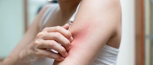 The Unbearable Itchiness of Healing: Cracking the Itch Code