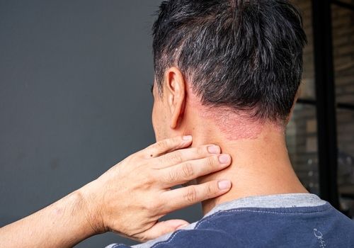 Psoriasis Troubles? Let's Scratch That.