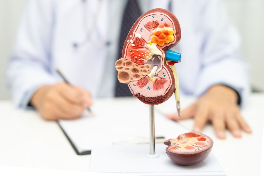 The Bitter Truth About Energy Drinks and Kidney Stones